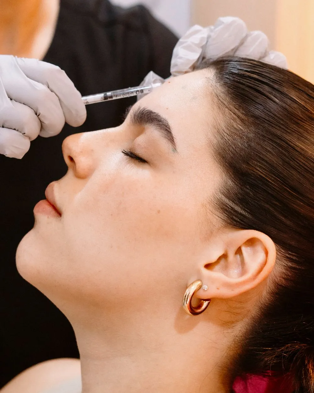 Injection de toxine botulique dans le front d'une patiente aux yeux fermés